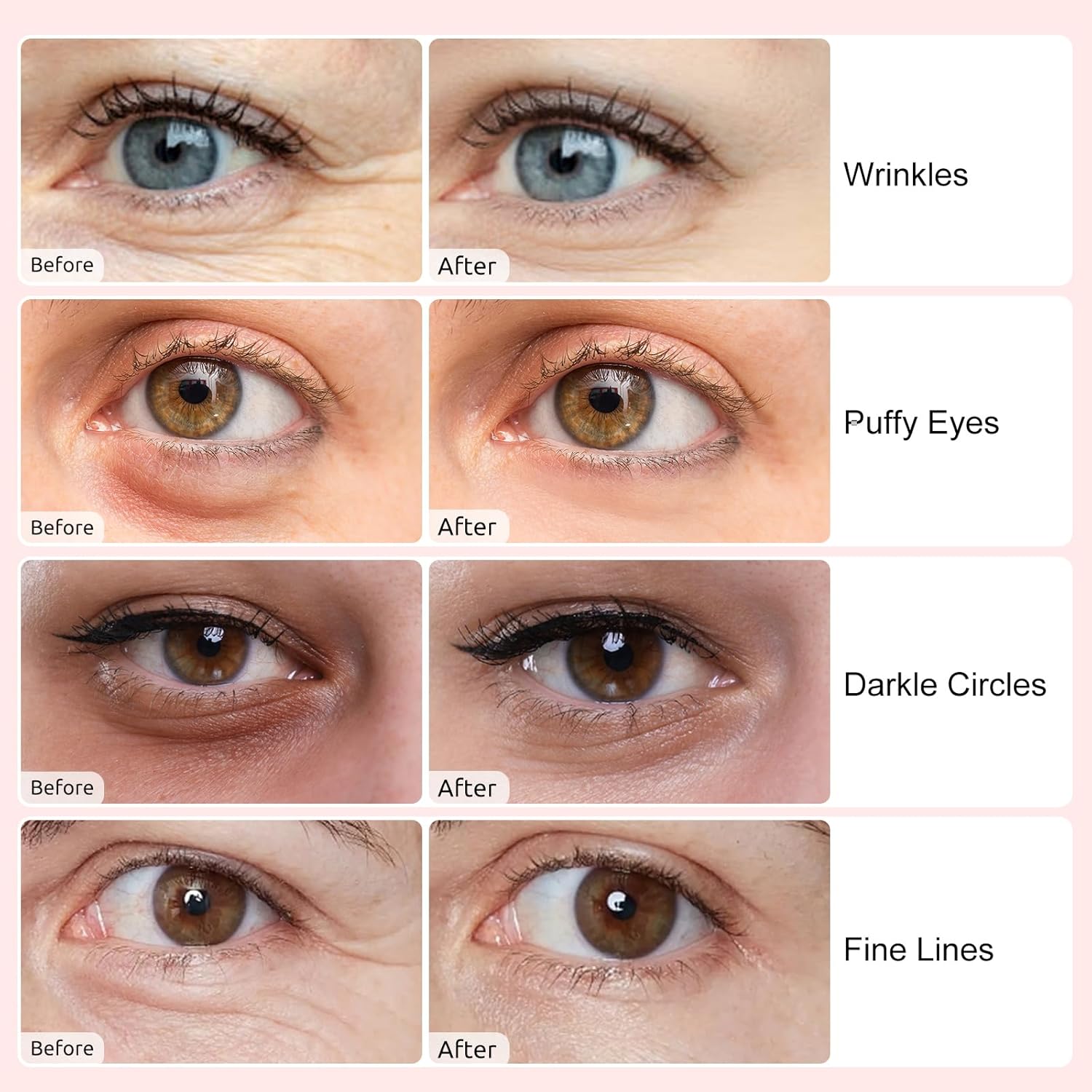 Permotary Under Eye Patches(40 Pairs), Collagen Crystal Eye Mask with Hyaluronic Acid, Under Eye Mask for Dark Circles, Puffy Eyes, Wrinkles, Treatment Skin Care