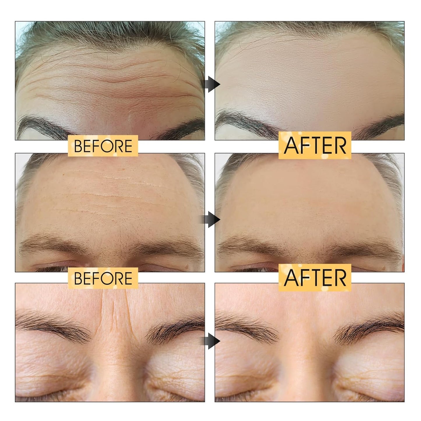 Permotary 20 Pcs Gold Forehead Wrinkle Patches Collagen Forehead Lines Mask Frown Wrinkles Pads with Collagen Boosting Elasticity for Women